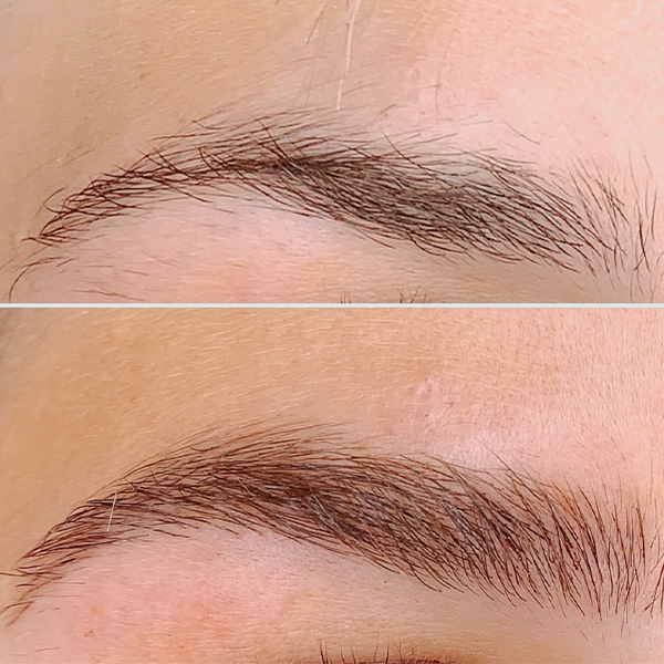 Eyebrow Tattooing | Restore Cosmetic and Medical Tattooing